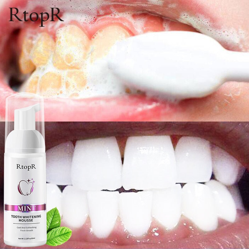 Tooth Whitening Mousse - Harpmart.shop