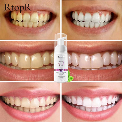 Tooth Whitening Mousse - Harpmart.shop