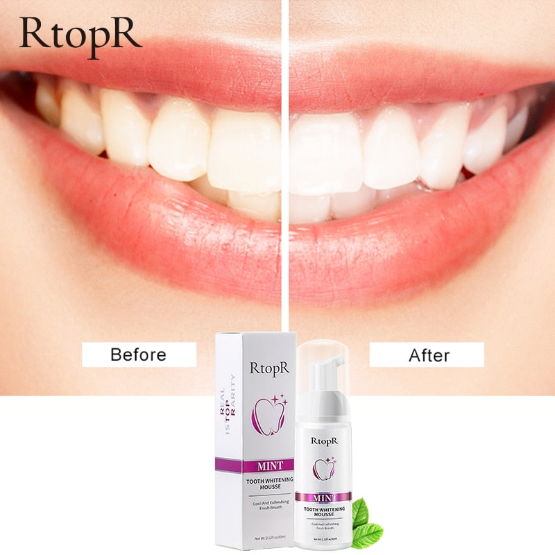 Tooth Whitening Mousse - Harpmart.shop